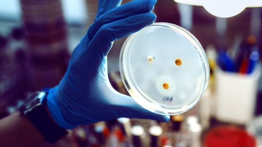 A person in laboratory wearing blue gloves is holding a Petri dish in the hand