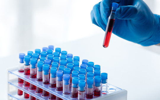 Hand provides blood reserves to 48 containers for later analysis.