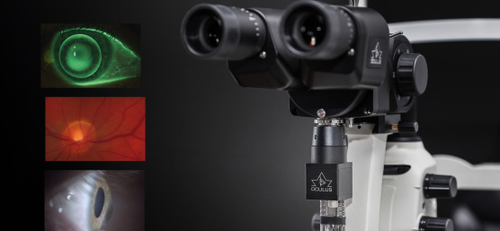 Slit lamp with IDS camera captures the anterior, middle and posterior segments of the eye.