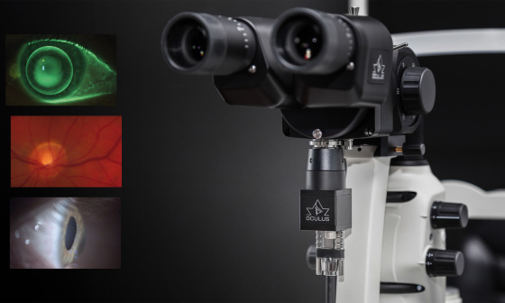Slit lamp with IDS camera captures the anterior, middle and posterior segments of the eye.