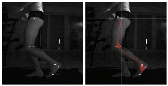 GIF of a person whose leg movement is being measured and examined.